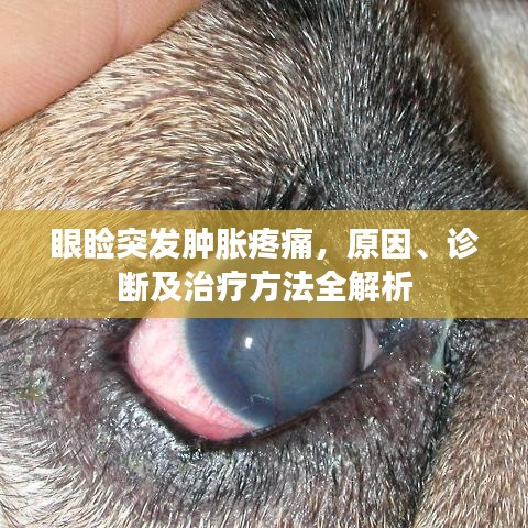 眼睑突发肿胀疼痛，原因、诊断及治疗方法全解析